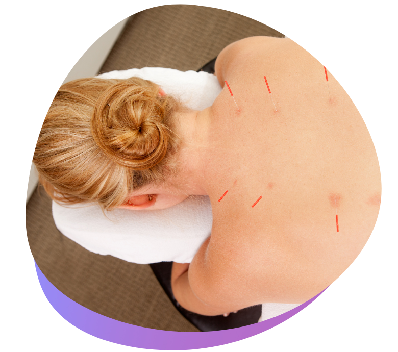 acupuncture-crowchild-Brentwood Shopping center